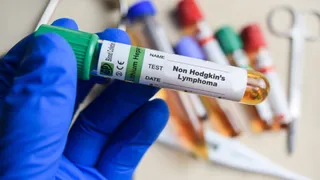 Roche resolves cancer test dispute with Stanford affiliated startup