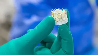 Edwards defends key heart valve product from infringement threat