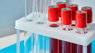 European court backs AstraZeneca unit in blood cancer combo dispute
