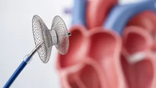 UPC hands Occlutech second win against Chinese medtech company in a month