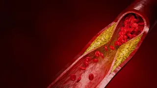 HeartFlow targets AI cardiac imaging rival over patents and trade secrets